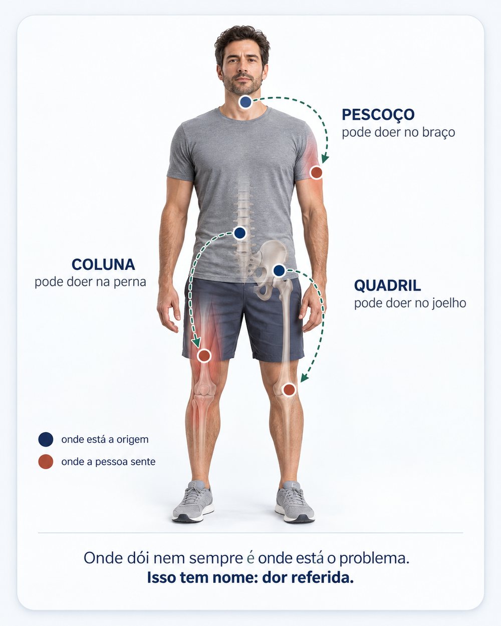 Mapa do corpo com três exemplos de dor referida: o pescoço pode doer no braço, a coluna pode doer na perna e o quadril pode doer no joelho. Onde dói nem sempre é onde está o problema.